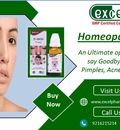 Homeopathic Medicine For Pimples