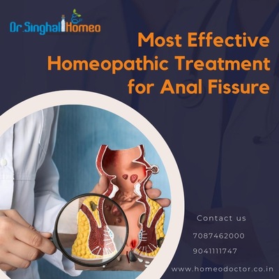 Get Homeopathic Medicine for Fissure for better Results